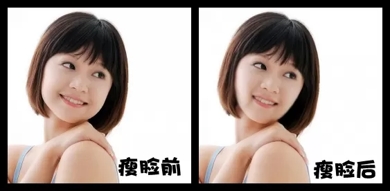 可牛影像瘦脸美容功能如何打造精致小脸？
